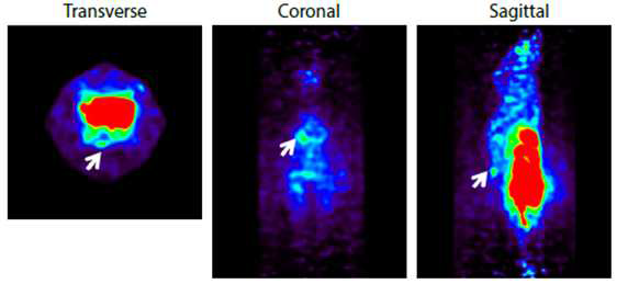 등에 피하이식된 폐암 모델에서 관찰된 F-MISO uptake(화살표)