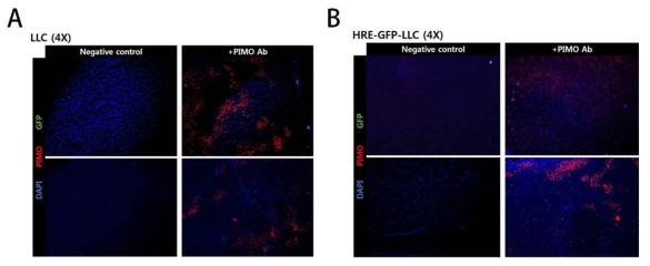 Lewis lung carcinoma (A) 또는 HRE-GFP를 발현하는 Lewis lung carcinoma (B)를 in vivo 종양 모델로 확립 한 후 적출하여 GFP에 대해 면역 염색을 수행한 이미지