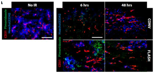 통상적 방사선 (CONV)을 조사하였을 때와 FLASH 초고속 방사선을 조사 하였을 때의 종양혈관 (CD31) 모습의 차이를 보여주는 면역 염색 이미지