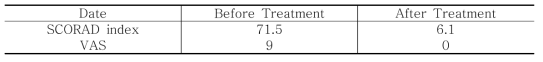 Case 1: Clinical Progress of SCORAD Index & VAS