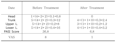 Case 2: Clinical Progress of PASI & VAS