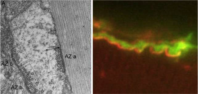 기능성 기판을 이용한 신경－근육 접합부 형성 결과 (왼쪽, 전자현미경 이미지), (오른쪽, 오른쪽)