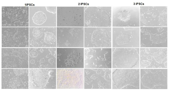 iPSC cell line (x3) 획득