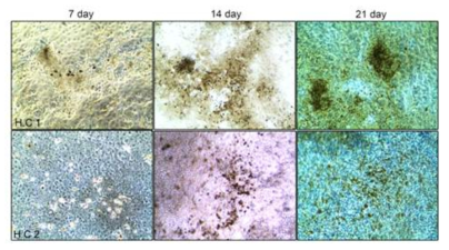 osteoblast differentiation from iPSC (von Kossa stain)