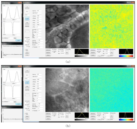 마우스 피부조직 영상 (a) 정상조직 (b) 암조직 (왼쪽: 일반 공초점 형광 이미지, 오른쪽: 공초점 형광수명 이미지)