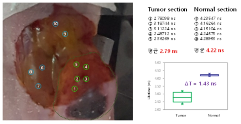 마우스 암조직과 정상조직 내 주입된 Sodium fluorescein의 형광수명 측정 결과