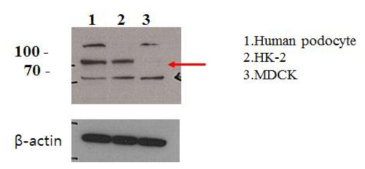 Podocyte, 근위세뇨관(HK-2), 원위세뇨관(MDCK)의 LOXL2 발현