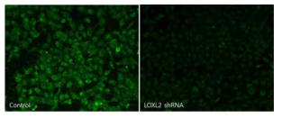 shRNA를 이용해 HK-2 세포의 LOXL2 발현을 억제시킴