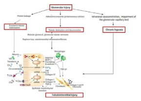 사구체 손상에 이은 세뇨관-사이질 섬유화의 발생 기전 (Kidney Int 2008; 74: 1233-6에서 변형하여 인용함)