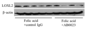 신장조직에서 LOXL2의 발현을 측정하였을 때 AB0023 처치군에서 현저히 감소하였음