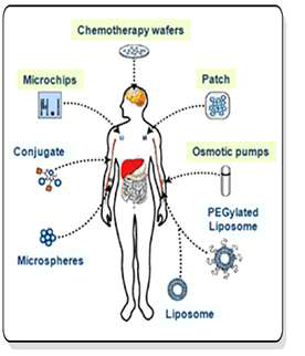 다양한 약물전달시스템
