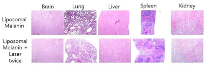 멜라닌 함유 나노 리포좀 주사 후 CT26 마우스의 주요 장기의 H&E 염색사진