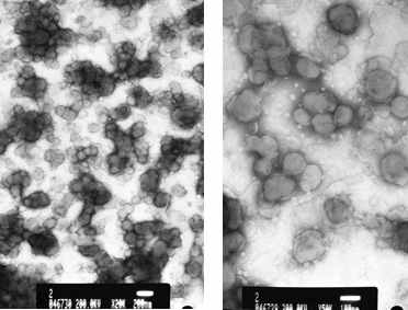 멜라닌 함유 나노리포좀의 투과전자현미경 사진. The scale bars: 200 nm (왼쪽)와 100 nm (오른쪽)