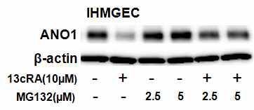 Proteasome inhibitor MG132에 의한 ANO1 단백질 degradation 억제