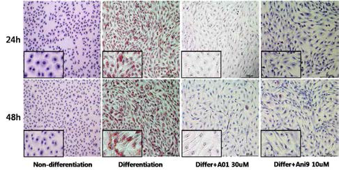 ANO1 활성 억제에 의한 Lipid staining 양상