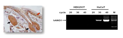 피지샘과 인간각질세포(HaCaT)에서의 아녹타민1의 발현 양상