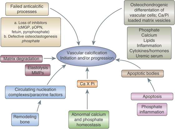 Major mechanisms of vascular calcification