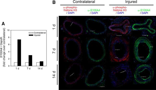 The expression level of S100A4 is dramatically changed in the blood vessels in neointimal injury model