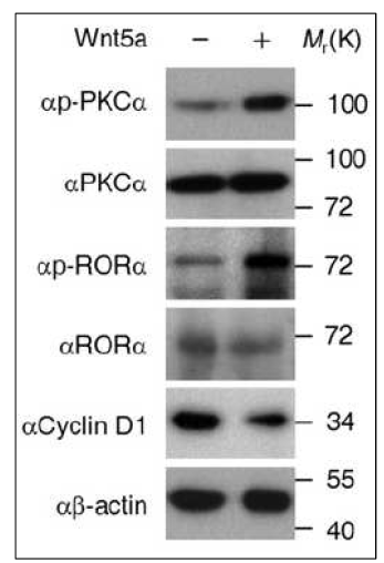 Wnt5a 처리 후 IB로 단백질 발현을 확인
