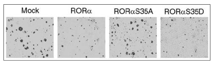 RORα 인산화에 의한 암세포 성장 실험