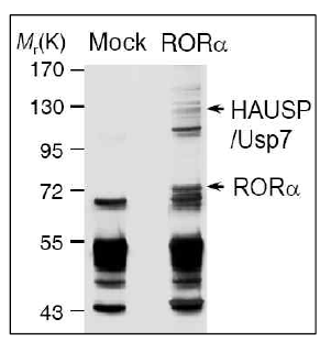 RORα 결합단백질로 HAUSP 발견