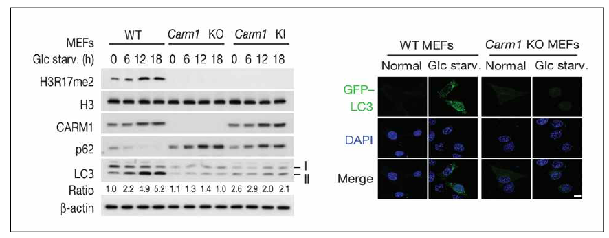 당 결핍에 따른 H3R17메틸화와 CARM1 단백질 증가 확인 및 CARM1 결손 MEFs에서 오토파지 저해 현상 관찰