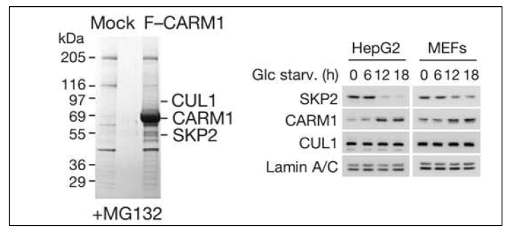 CARM1단백질 복합체 분석에서 SKP2 동정(좌) 당결핍 상황에서 SKP2와 CARM1의 역상관 관계(우)