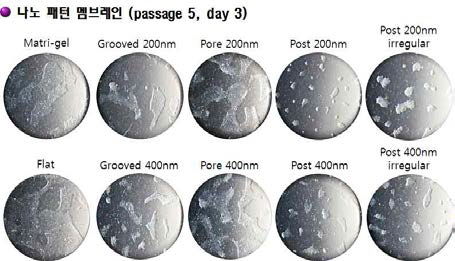 나노 패턴 멤브레인에 의한 유도만능줄기세포의 부착 및 증식 확인을 위한 Phase 사진