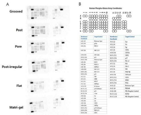 Proteome Profiler Human Phospho-Kinase Array Kit를 이용한 프로티옴 프로파일링 분석. P3에서 확인한 결과 (A)와 kit로 분석 가능한 Phospho-Kinase (B)