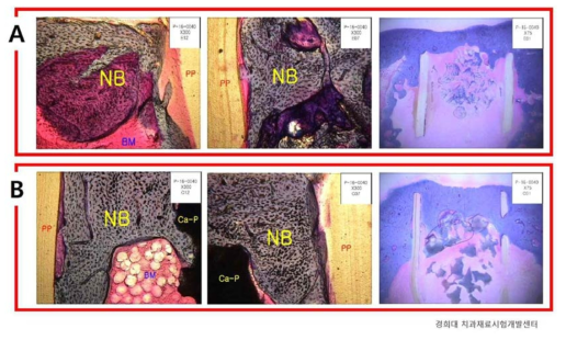 (A) 합성된 자연모사 인공조직과 (B) 시중에 판매되는 합성골 이식재인 M 제품을 토끼의 경골에 이식 후, 12주 뒤의 비교 사진