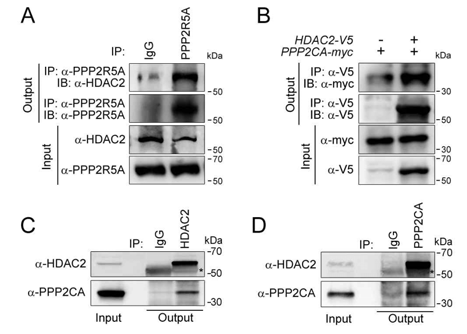 HDAC2 physically interacts with PP2A