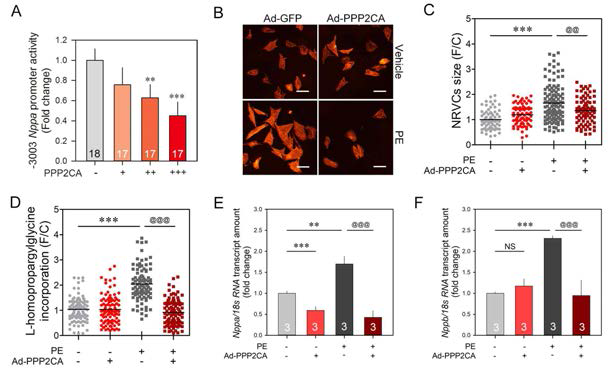 PP2CA attenuates hypertrophic responses