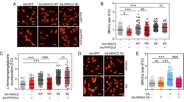 PP2CA targets S394 phosphorylation of HDAC2 to modulate the hypertrohpic signal