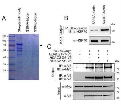 HSP70, a novel binding partner of phosphorylated HDAC2