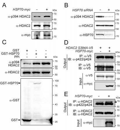 HSP70 is required for the phosphorylation of HDAC2