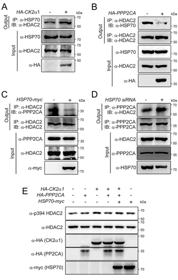 CK2a1 increases binding of HSP70 to HDAC2, while PP2A decreases it