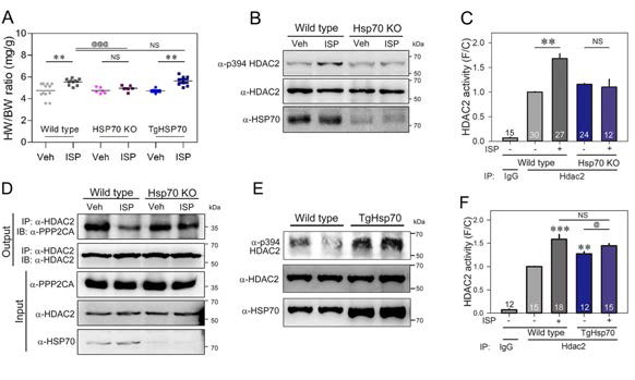 Hypertrophic responses and HDAC2 activity in HSP70 overexpression (TgHSP70) and knockout (HSP70 KO) mouse heart
