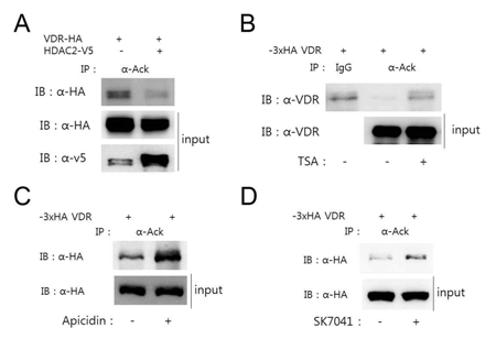 VDR acetylation is regulated by HDAC2