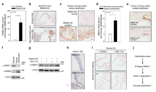 MDM2 E3 ligase-mediated ubiquitination and degradation of HDAC1 in vascular calcification