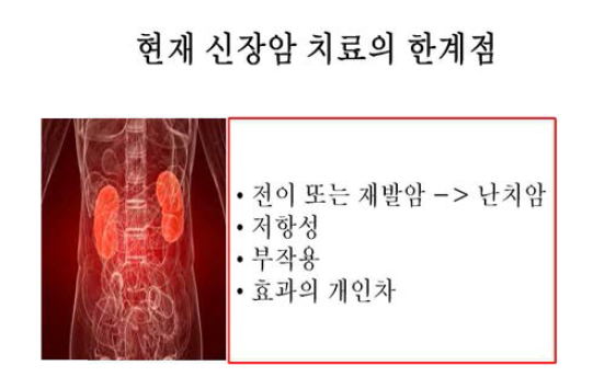 현재 신장암 치료의 한계점