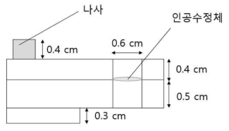 인공수정체 홀더 구조도