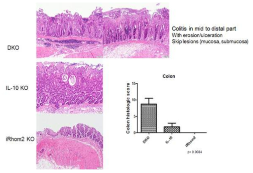 마우스별 m2/IL-10 이중유전자 결핍 마우스의 자발적 대장염 모델에서의 조직학적 소견