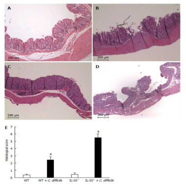 IL-10 유전자 결핍 마우스에서 C. difficile 감염에 의한 대장의 조직학적 소견 변화