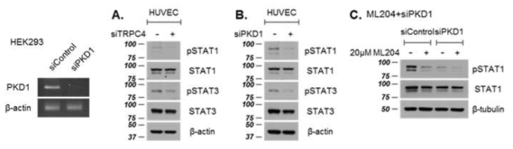 PC-1과 TPRC4 억제에 의한 STAT1, STAT3 활성