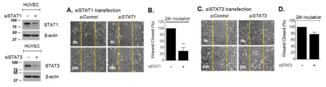 Endothelial cell migration에서 STAT1과 STAT3의 역할