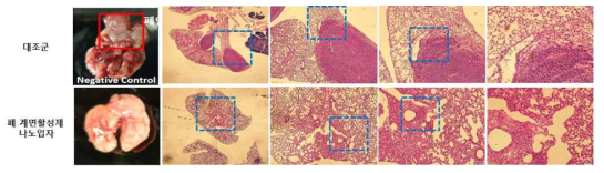 폐 계면활성제 기반 항암치료 유무의 폐암 실 이미지 및 H&E 염색 이미지