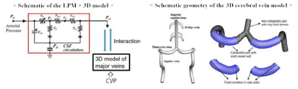 대뇌정맥 혈류해석을 위한 CFD-LPM 결합도 및 FSI 계산구역 설정