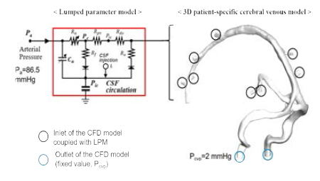 Patient-specific cerebral vein model에 대한 CFD-LPM 결합도