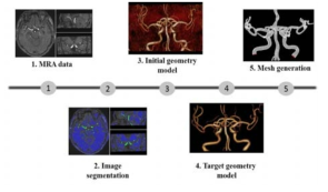 뇌혈관 모델링 절차 개요도