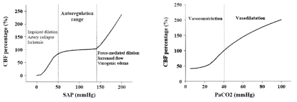 LPM에 적용된 뇌혈관 자동조절능 및 PaCO2에 따른 혈류량 변화패턴